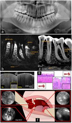 Multiphoton Microscopy of Oral Tissues: Review